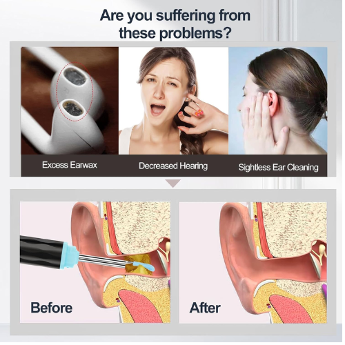 Ear cleaner with camera